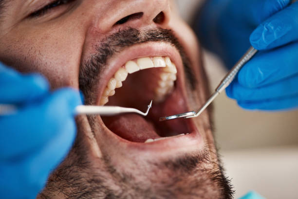 Best Cracked Tooth Emergency Dentist  in Colusa, CA